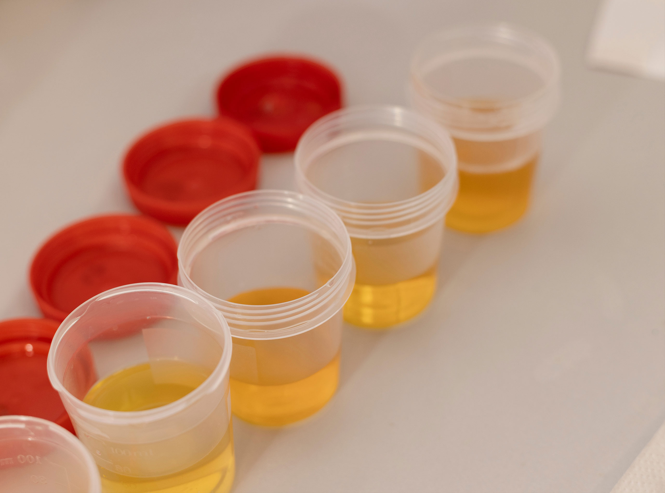 Featured image for “Collecting A Urine Sample For Your Pet’s Urine Protein Creatinine Ratio”